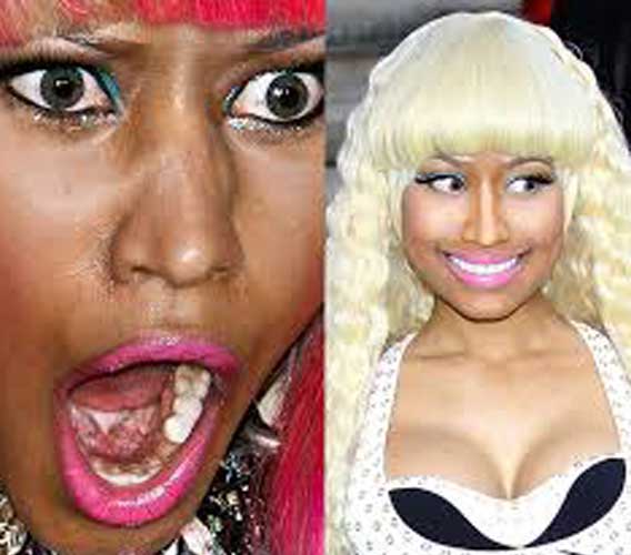 Nicki-Minaj-Skin-Lightening