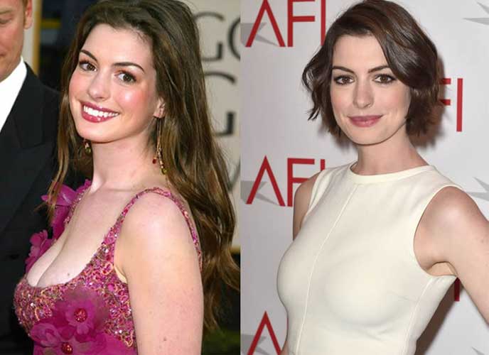 Anne Hathaway Plastic Surgery