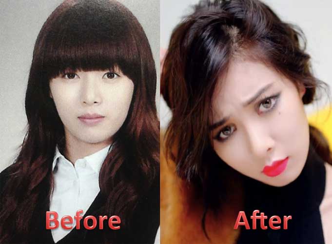 Kim Hyuna Plastic Surgery