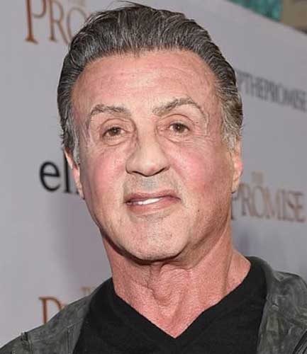 Sylvester Stallone Plastic Surgery