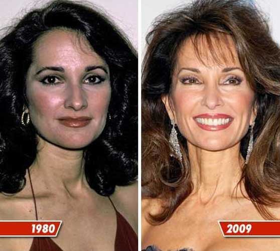 Susan Lucci plastic surgery 