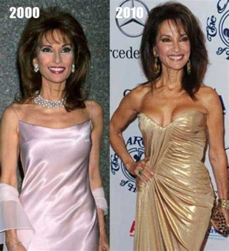 Susan Lucci plastic surgery 