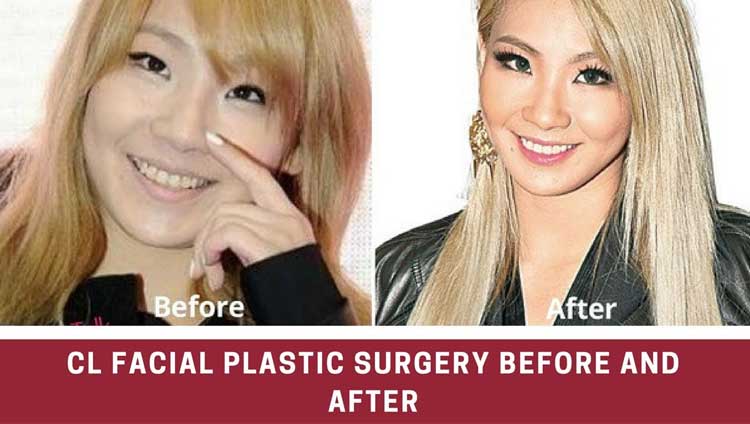 CL Plastic Surgery 