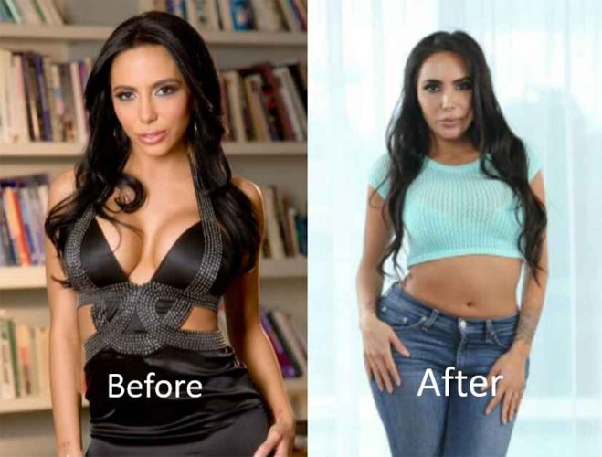 Lela-Star-Plastic-Surgery-Before-and-After