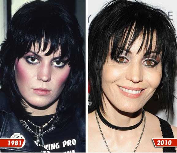 Joan Jett plastic surgery