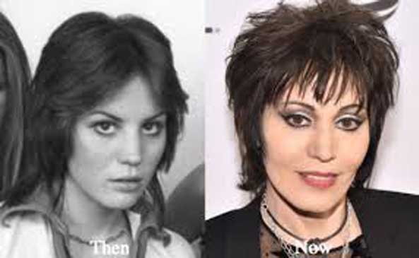 Joan Jett plastic surgery 