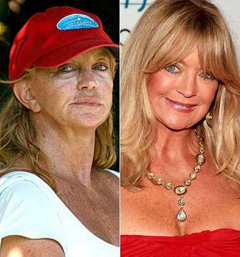 Goldie Hawn Plastic Surgery