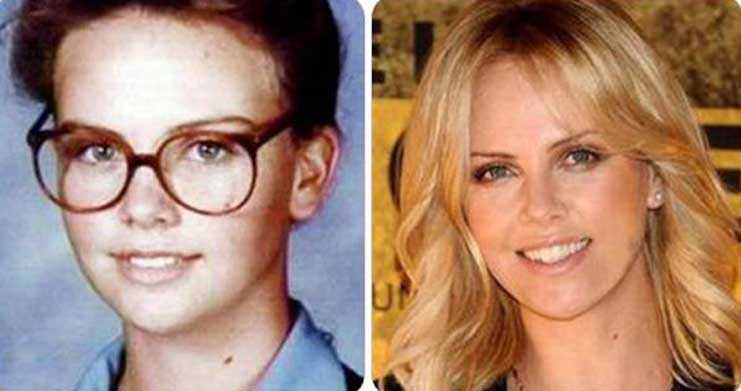 Charlize Theron plastic surgery