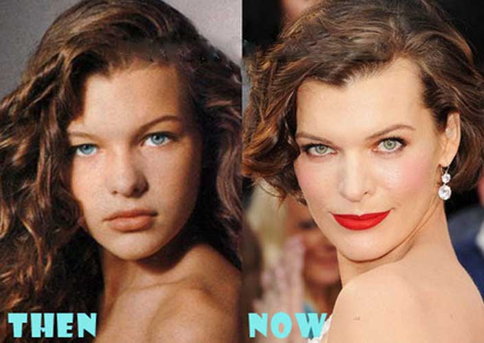 Milla Jovovich plastic surgery