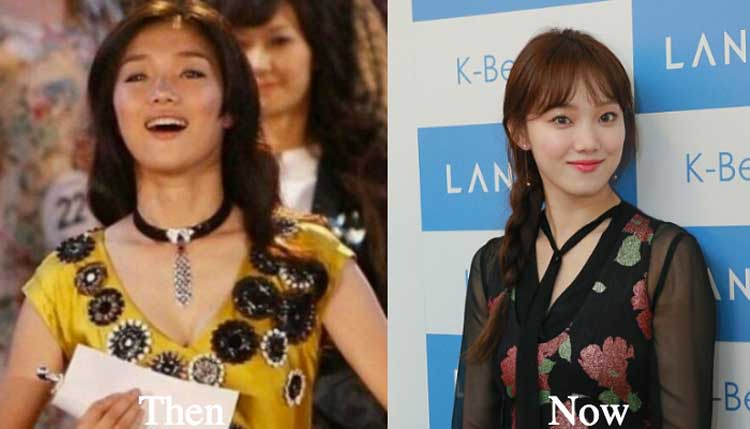 Lee Sung Kyung plastic surgery 