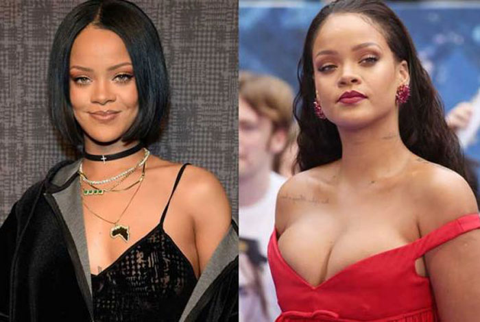 Rihanna plastic surgery