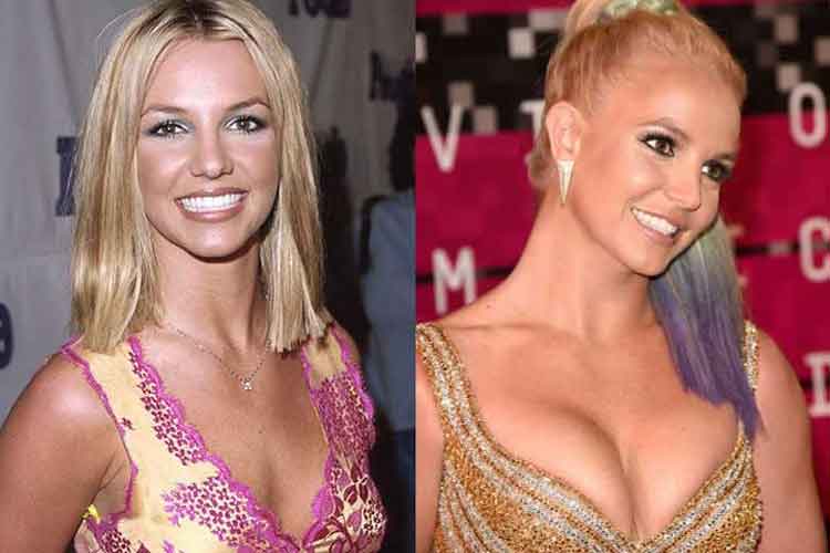 Britney Spears plastic surgery 