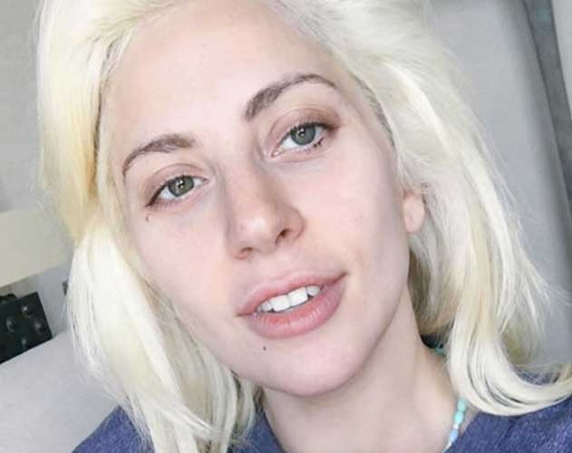 Lady Gaga Plastic Surgery
