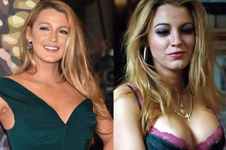 Blake Lively Plastic Surgery Before And After