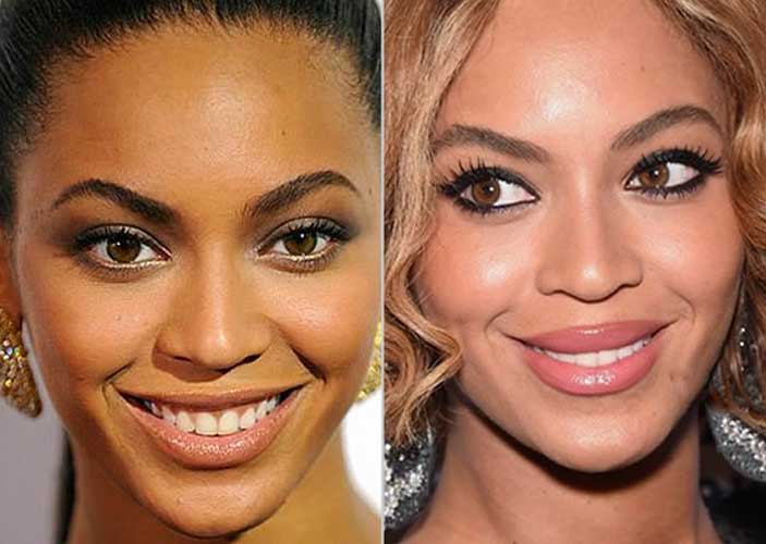 Beyonce Plastic Surgery
