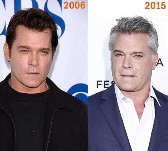 Ray Liotta Plastic Surgery before and after