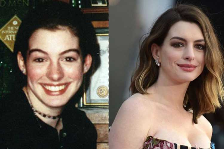 Anne Hathaway Before and After