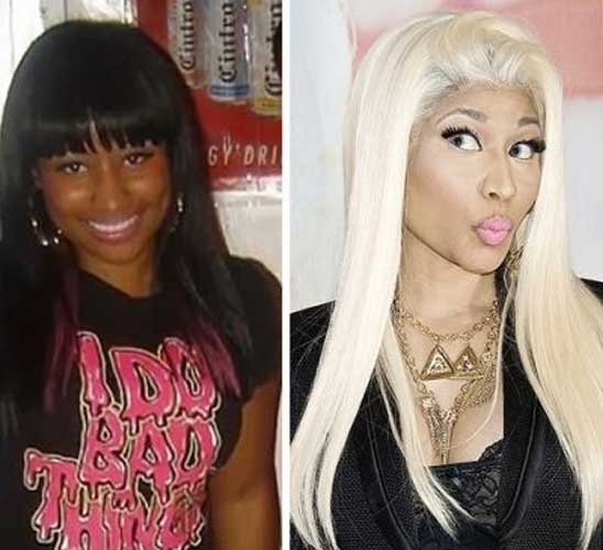 Nicki Minaj Plastic Surgery
