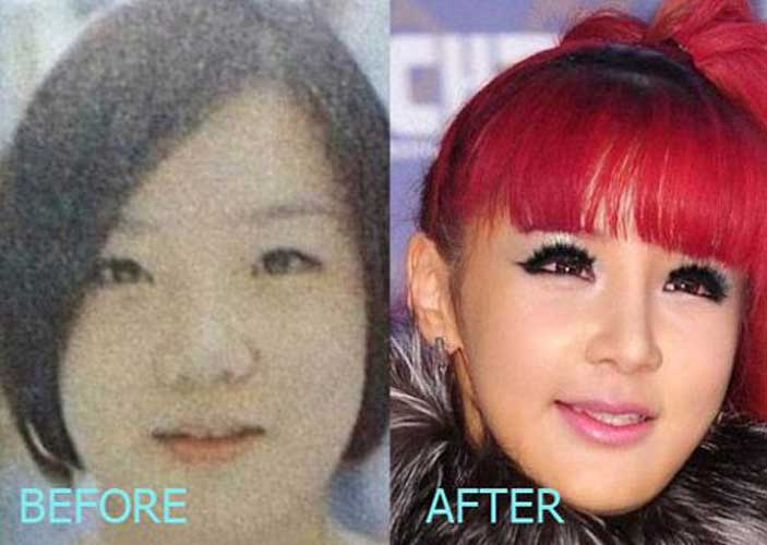 Park Bom Plastic Surgery
