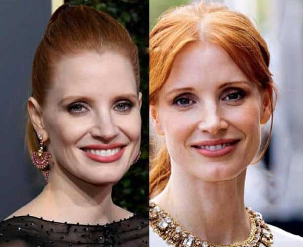 Jessica Chastain Plastic Surgery