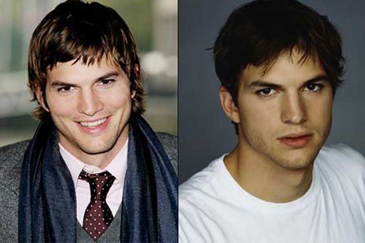 Ashton Kutcher Plastic Surgery 