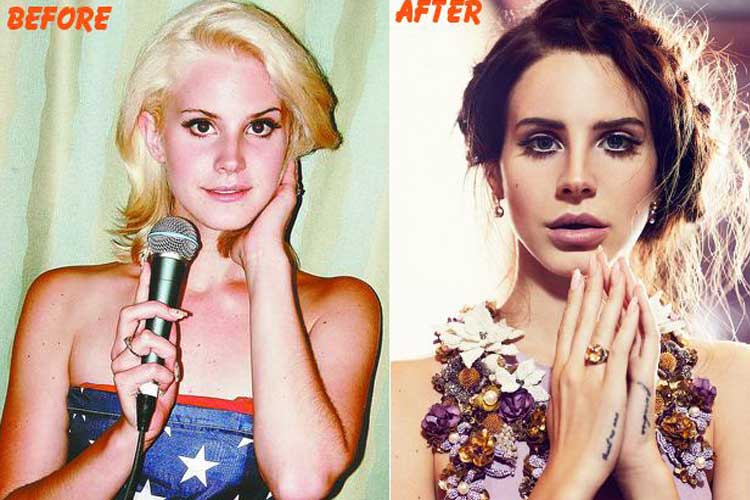 Lana Del Rey plastic surgery Lip Filler, Nose Job, Breast