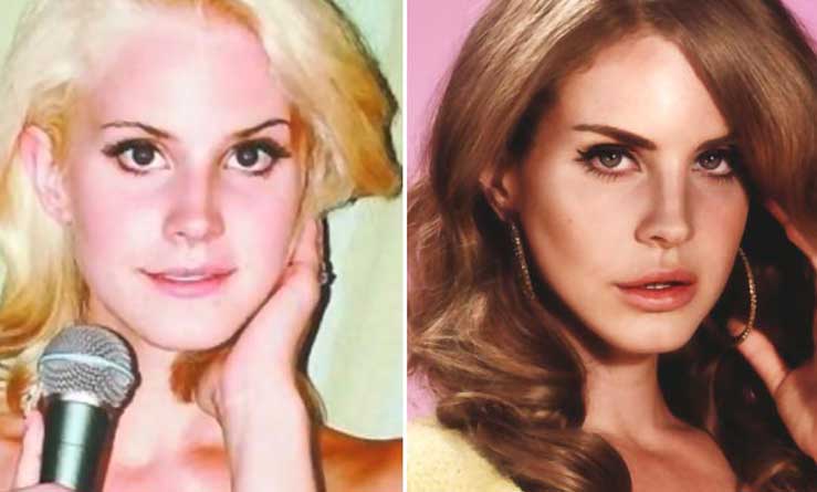 Lana Del Rey plastic surgery