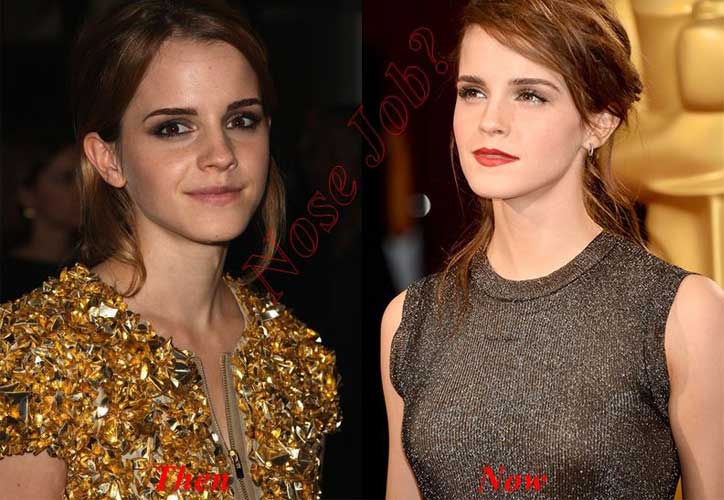 Many of us may have noticed how emma watson grows. 