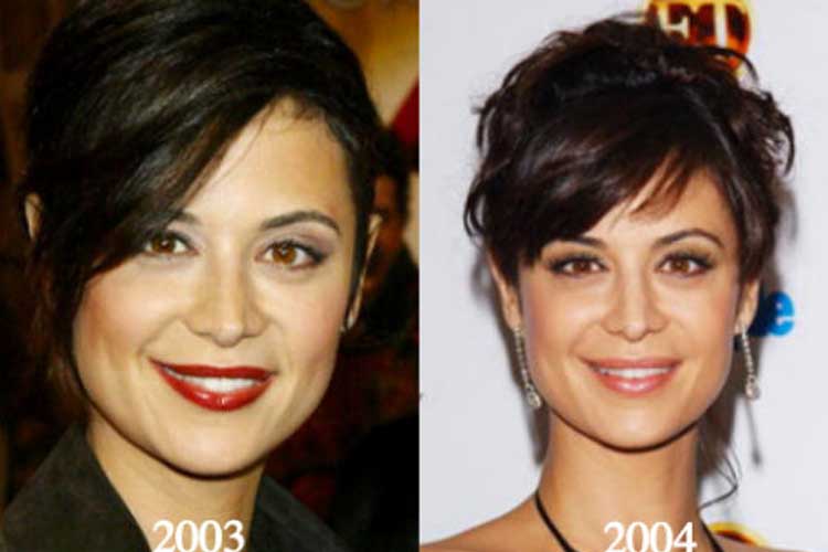 Catherine Bell Plastic Surgery Nose Job Eyelid After And Before.