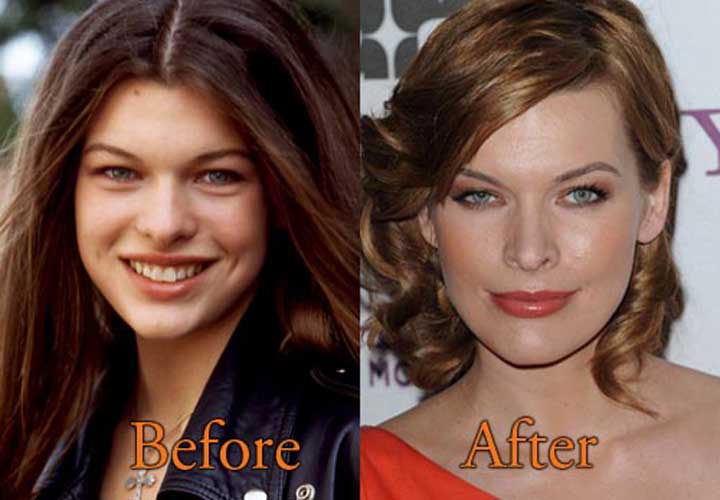 Milla Jovovich Plastic Surgery All in one Photos.