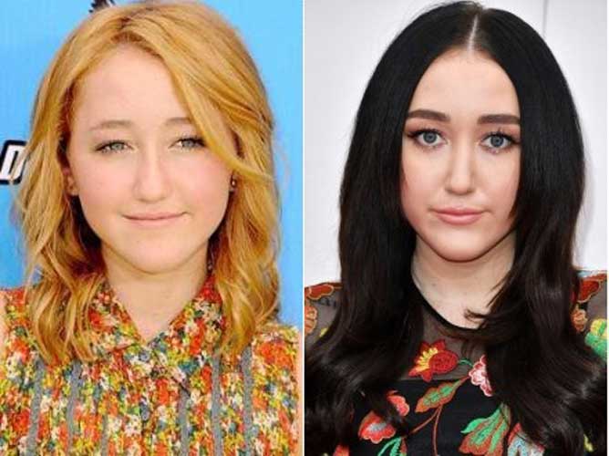 It is surely hard to say that noah cyrus plastic surgery is just a gossip. 